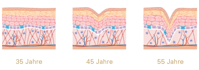 hypen-haut